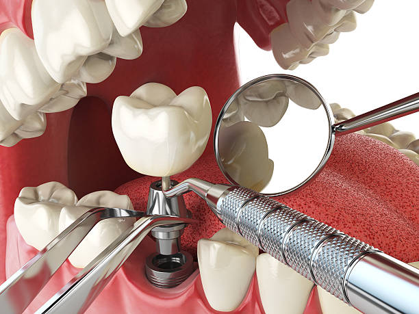 Best Tooth Infection Emergency Dentist  in Glen Carbon, IL